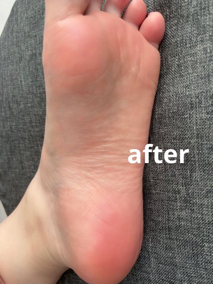 イージーパックDP60分タイプ/ベビーフット/レッグ・フットケアを使ったクチコミ(7枚目)