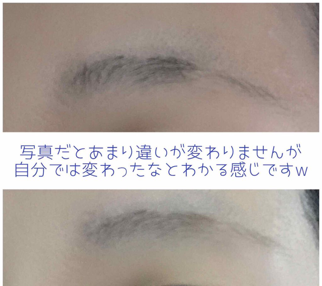 脱色クリーム スピーディー/エピラット/ムダ毛ケアを使ったクチコミ(3枚目)