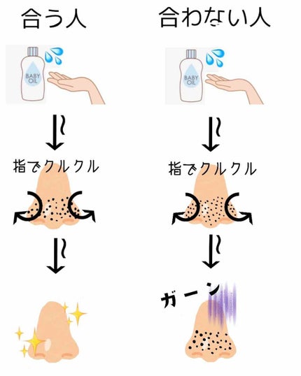 ジョンソン ベビーオイル 無香料/ジョンソンベビー/ボディオイルを使ったクチコミ(3枚目)