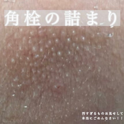 デュオ ザ クレンジングバーム ブラックリペア /DUO/クレンジングバームを使ったクチコミ(5枚目)