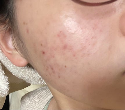 を使ったクチコミ(3枚目)