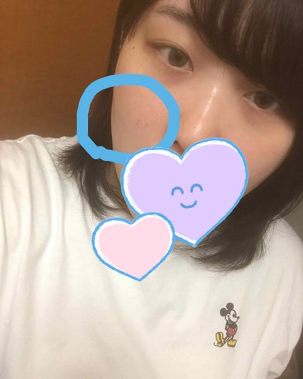 メラノCC 薬用しみ集中対策液(旧)/メラノCC/美容液を使ったクチコミ(3枚目)