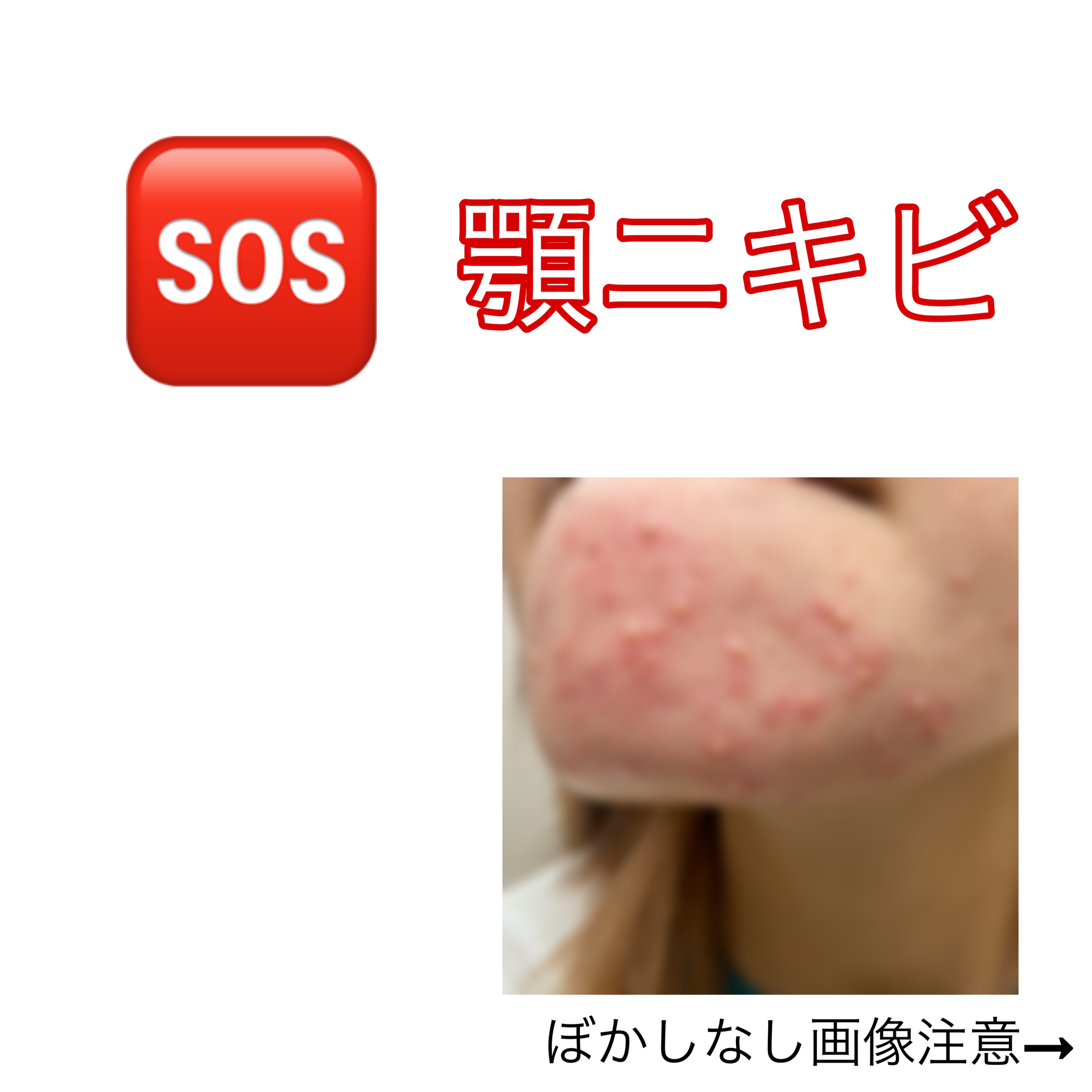 ガラクナイアシン2.0エッセンス/manyo/美容液を使ったクチコミ（1枚目）