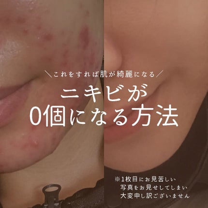 CICA デイリースージングマスク/VT/シートマスク・パックを使ったクチコミ(1枚目)