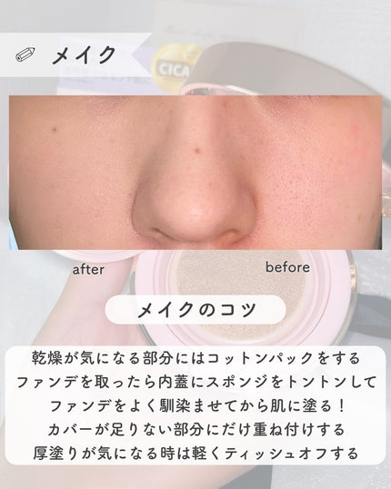 ピンクティーツリーカバーアップグロウクッション/APLIN/クッションファンデーションを使ったクチコミ(4枚目)