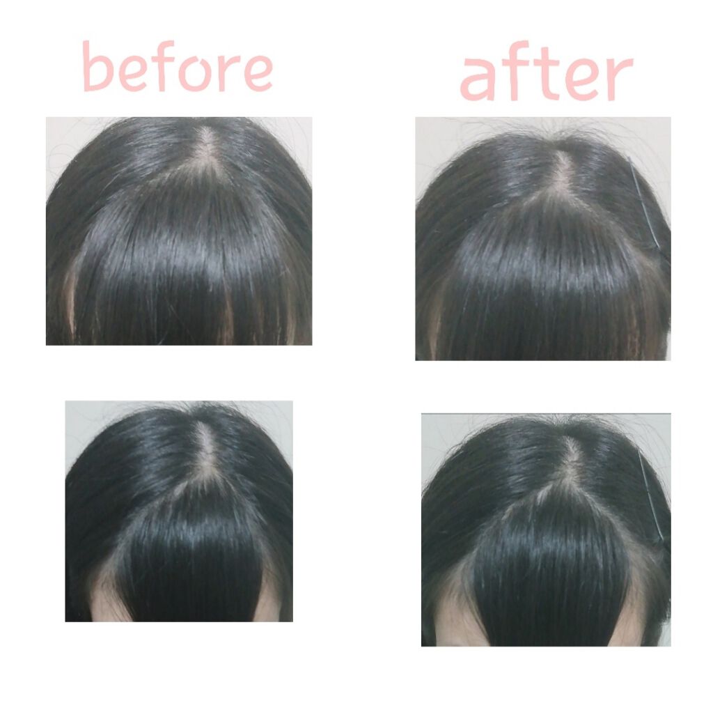 あず ⸜❤︎⸝ on LIPS 「どうも!!あずです!!2日連続投稿するとは思ってなくて自分でも..」(2枚目)