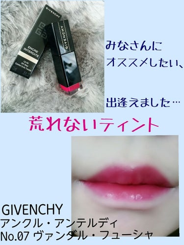 アンクル・アンテルディ/GIVENCHY/口紅を使ったクチコミ（1枚目）