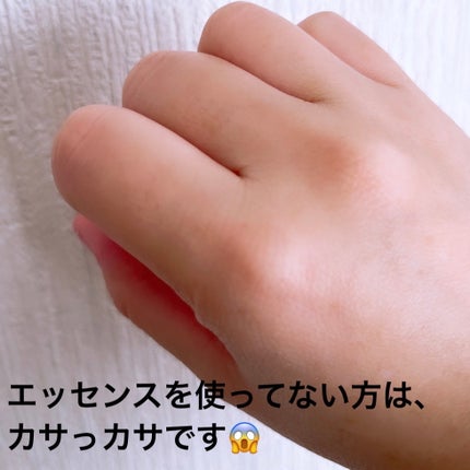 アンチリンクルファーストエッセンスオリジン/MIGUHARA/化粧水を使ったクチコミ(7枚目)