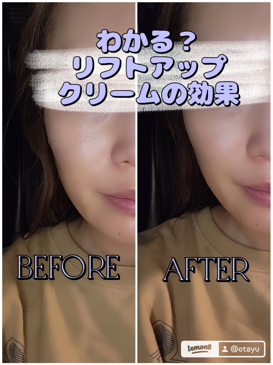 BIOHEAL BOH プロバイオダーム リフティング クリームのクチコミ「今日はばえない写真をあげてまで推したいクリームがあるので聞いてほしい。

バズってるから今更？.....」（1枚目）