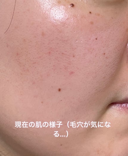 アミノ酸保湿ローション/Mマークシリーズ/乳液を使ったクチコミ(3枚目)