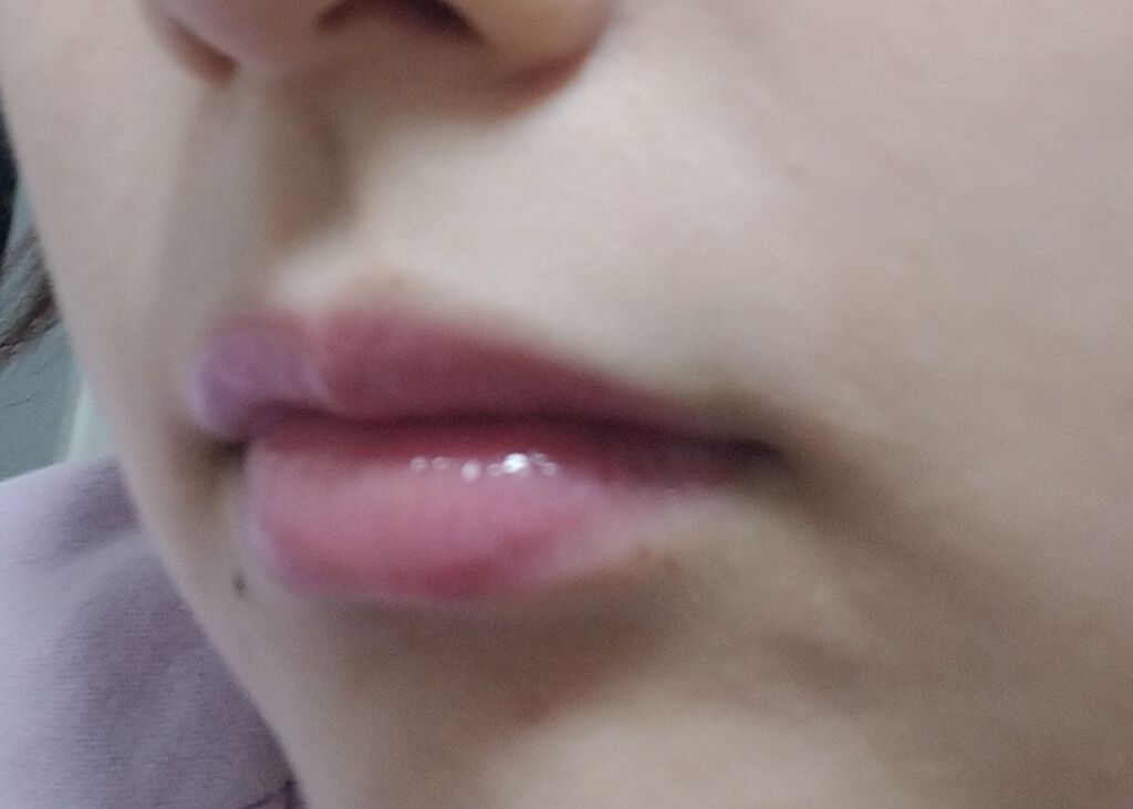 ディオール アディクト リップ グロウ オイル/Dior/リップグロスを使ったクチコミ（2枚目）