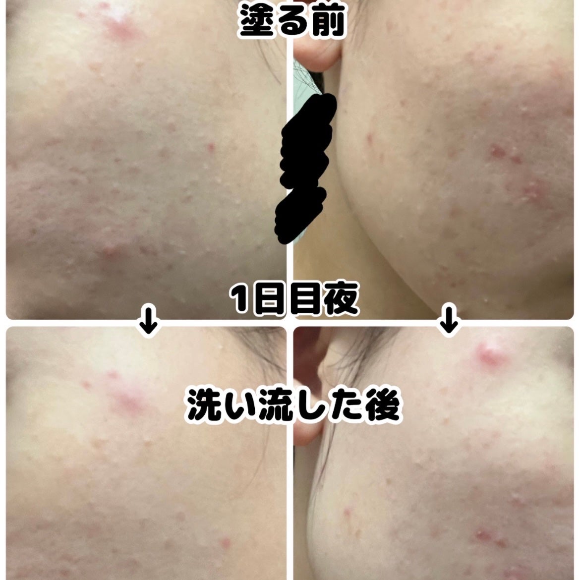 ベリーお元気?/ラッシュ/洗い流すパック・マスクを使ったクチコミ(5枚目)