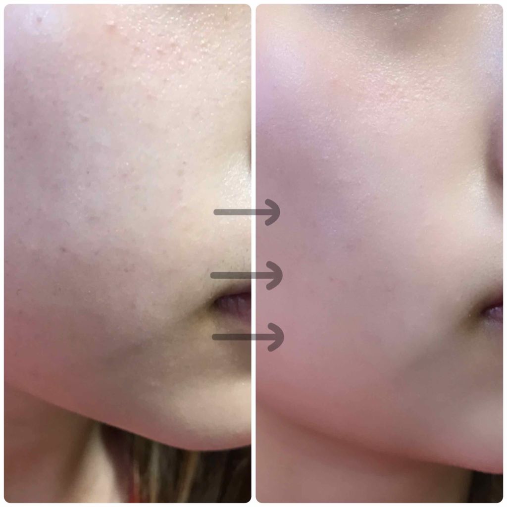 レソンシエル/GUERLAIN/リキッドファンデーションを使ったクチコミ（3枚目）