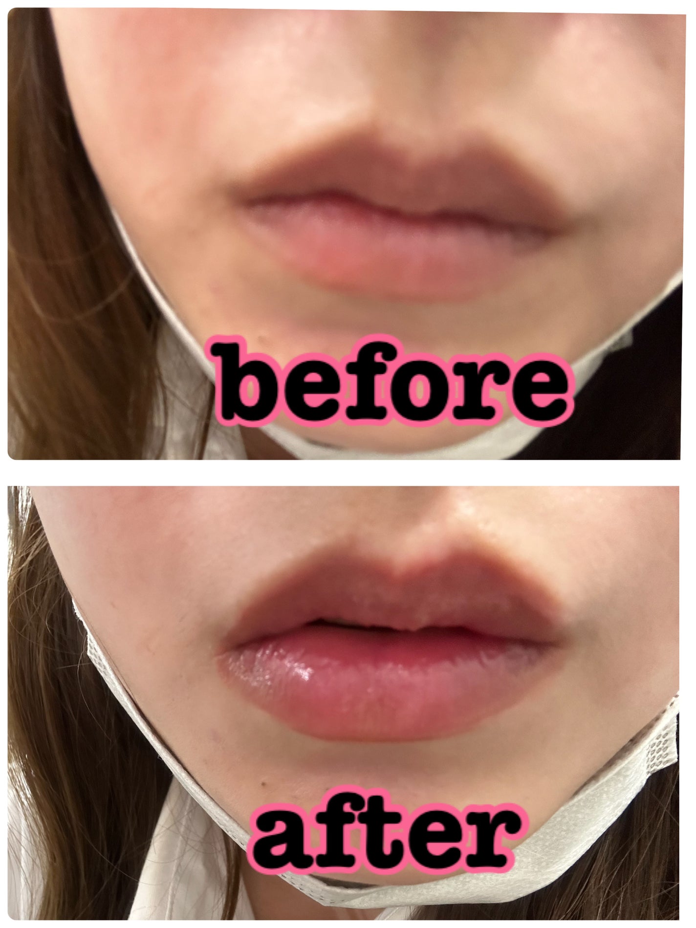 YNM レインボーハニーリップバーム/YNM/リップバームを使ったクチコミ(5枚目)