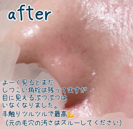 薬用 しみ 集中対策 美容液/メラノCC/美容液を使ったクチコミ(3枚目)