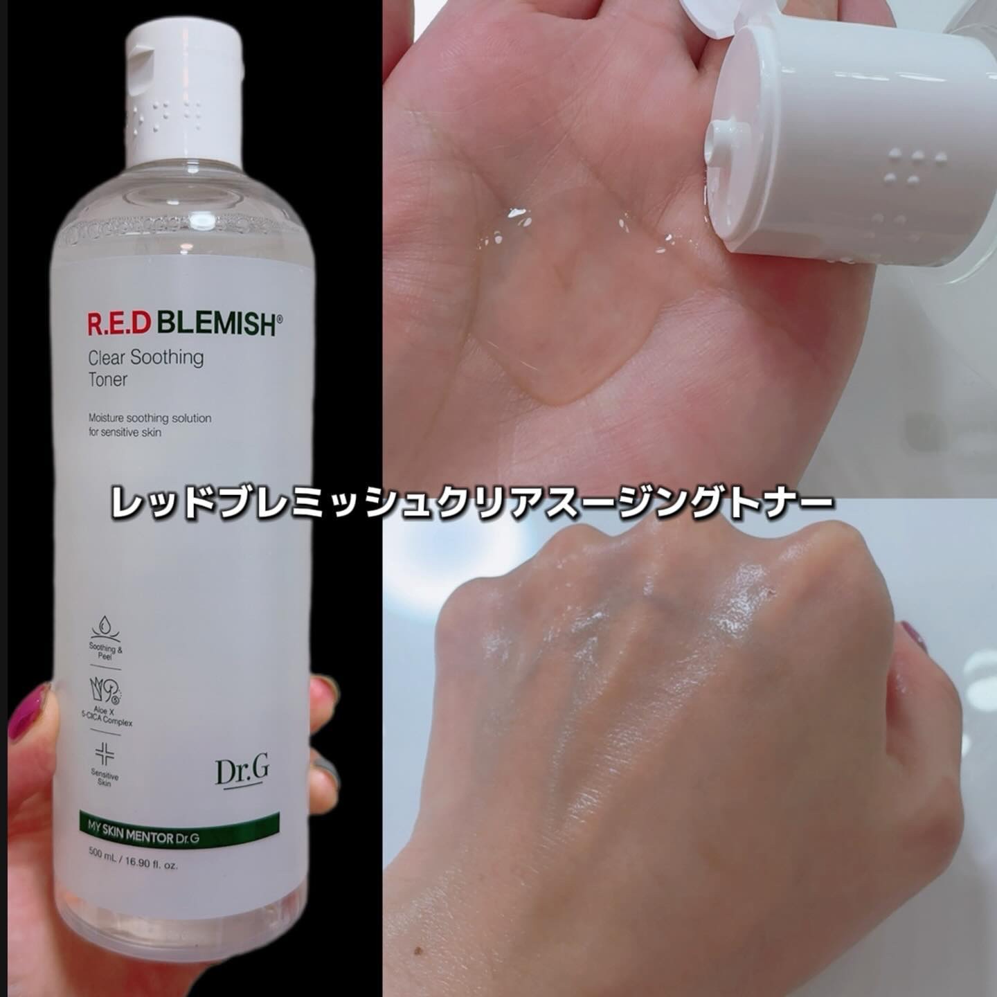 レッドブレミッシュ クリアスージングトナー/Dr.G/化粧水を使ったクチコミ（2枚目）