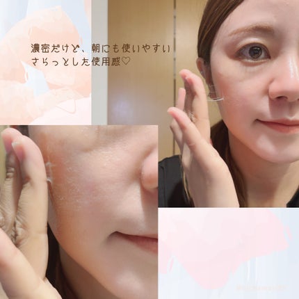 リマージ糸リフティングアンプル/REVENIP/美容液を使ったクチコミ(6枚目)