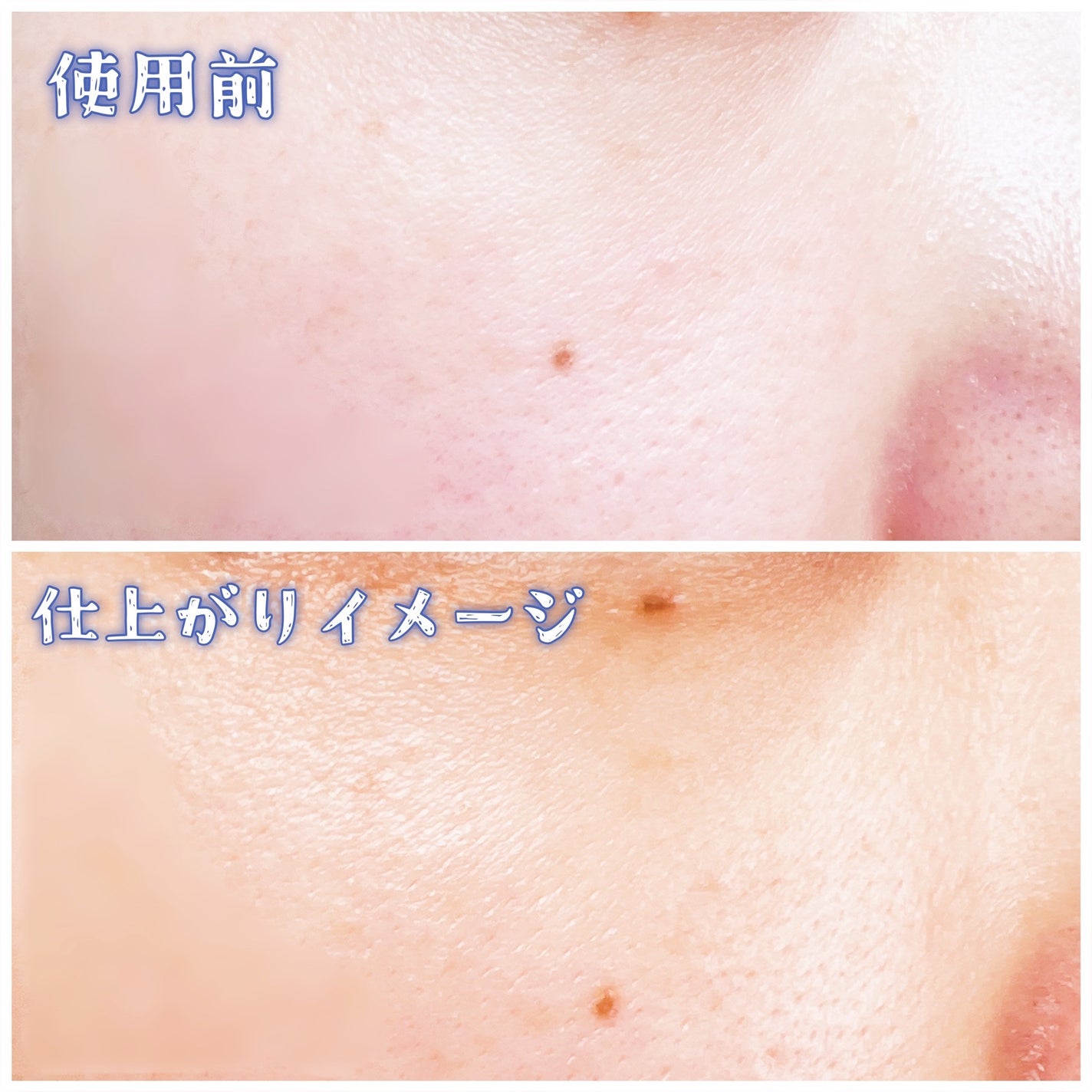 アンチオキシデントトラディアンスアンプル/V&Aビューティー/美容液を使ったクチコミ(5枚目)