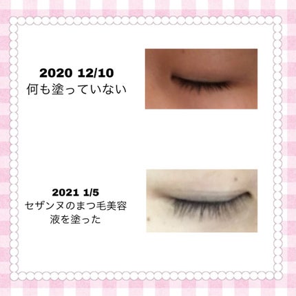 まつげ美容液EX/CEZANNE/まつげ美容液を使ったクチコミ(2枚目)