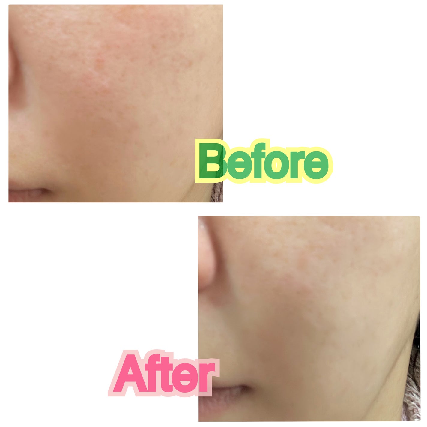 PHセンシティブマスクスージング&モイスト/SAM'U/シートマスク・パックを使ったクチコミ(5枚目)