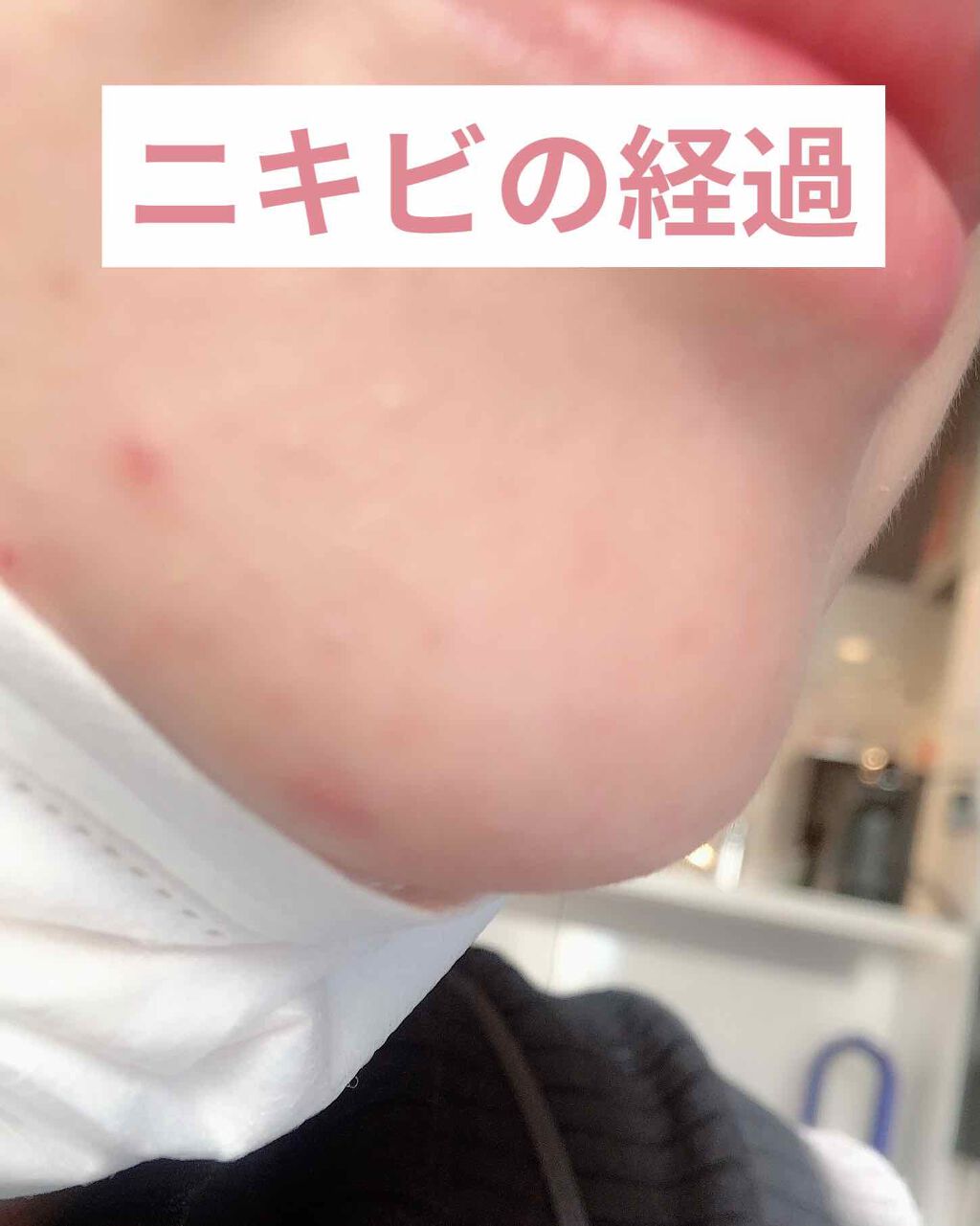 スマートモイスチャーデバイス （美顔器）/SALONIA/美顔器・マッサージを使ったクチコミ（3枚目）