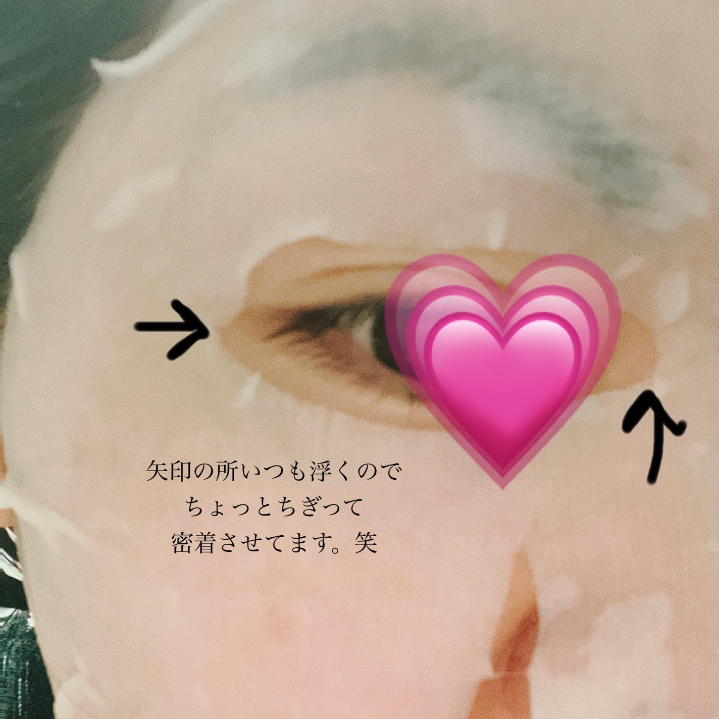 ごめんね素肌 キニナルマスク/クリアターン/シートマスク・パックを使ったクチコミ(4枚目)