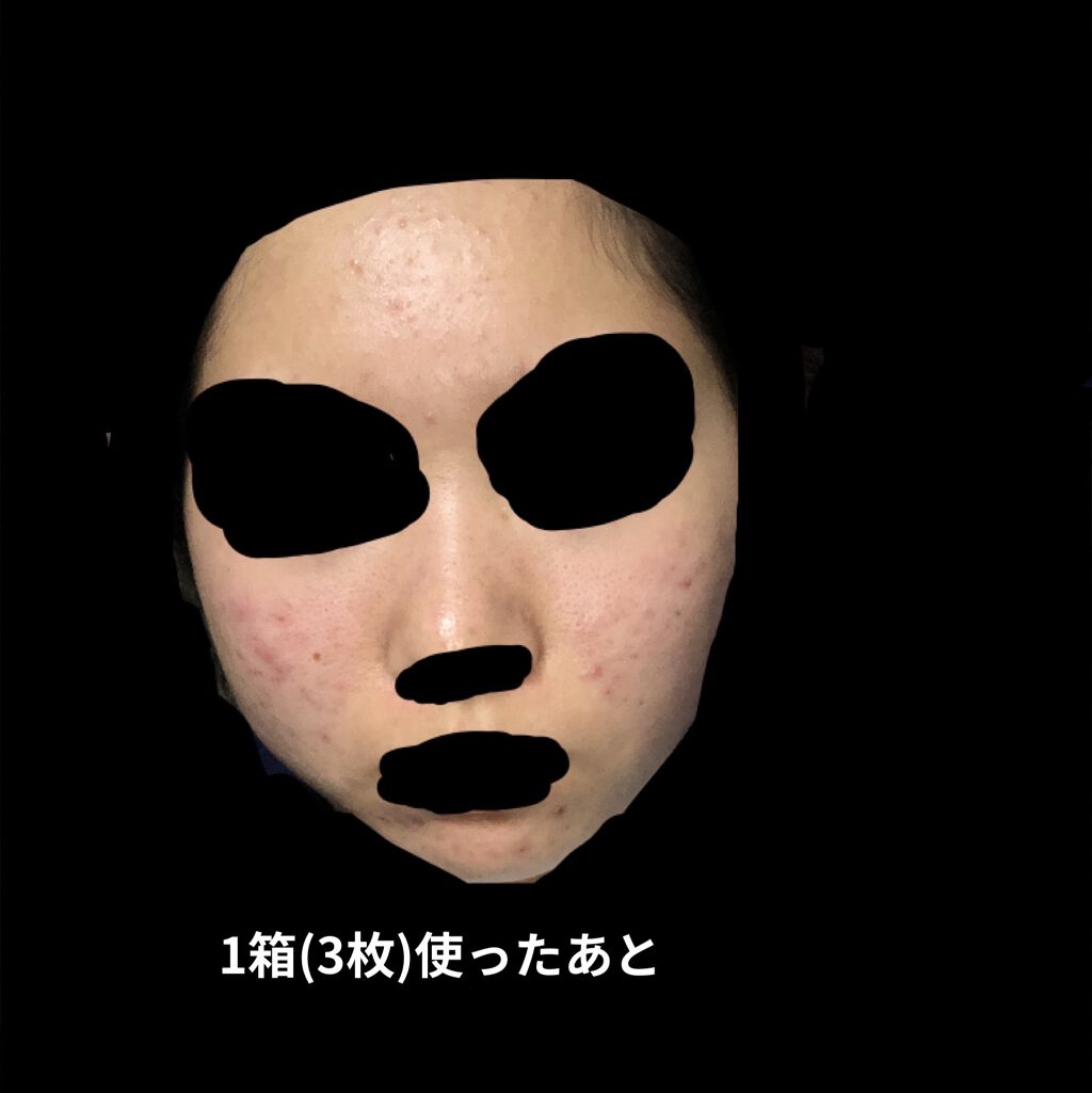 ティーツリーケアソリューション アンプルマスクJEX/MEDIHEAL/シートマスク・パックを使ったクチコミ（3枚目）