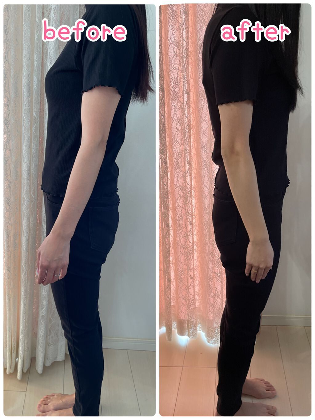 AB丸/韓国ABクリニック/ボディサプリメントを使ったクチコミ(10枚目)