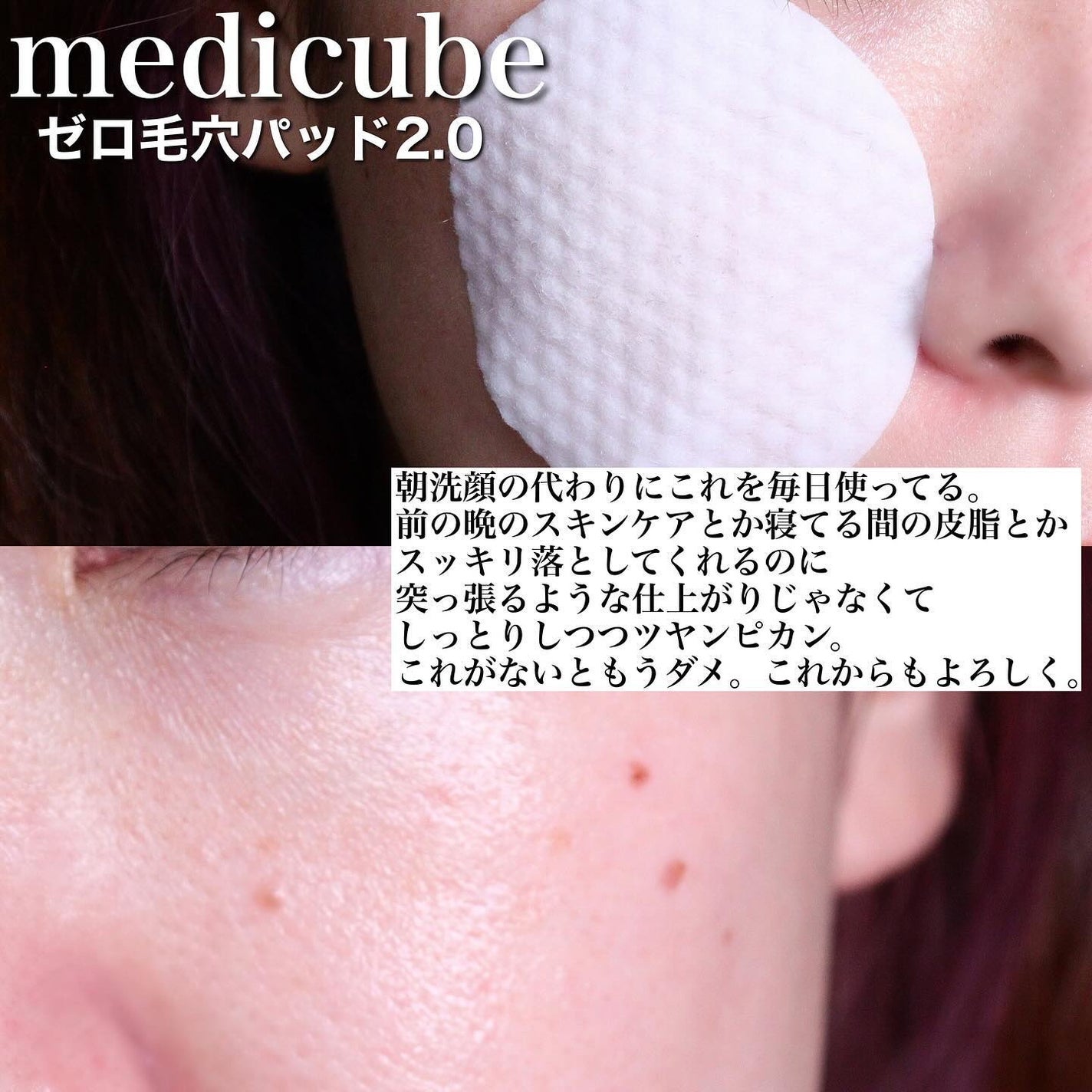 ゼロ毛穴パッド 2.0/MEDICUBE/トナーパッドを使ったクチコミ(4枚目)
