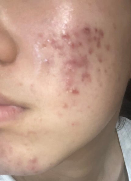 ã䜿ã£ãã¯ãã³ãïŒ1æç®ïŒ