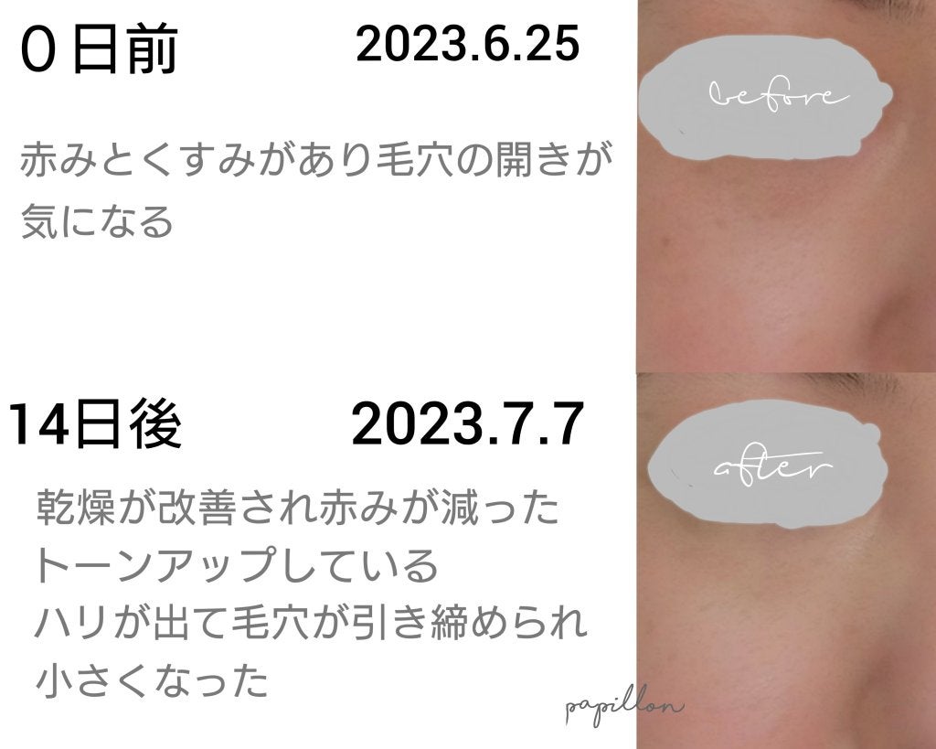 papillon on LIPS 「VTさまのモニターに当選しバイタルショットモニター2weekc..」(2枚目)