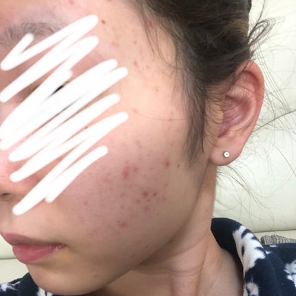 クレンジング ウォッシャブルコールドクリーム/POND'S/クレンジングクリームを使ったクチコミ(2枚目)