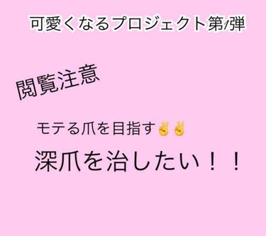 りん on LIPS 「こんにちは！唐突ですが私深爪なんです。。生まれてからずっと噛み..」（1枚目）