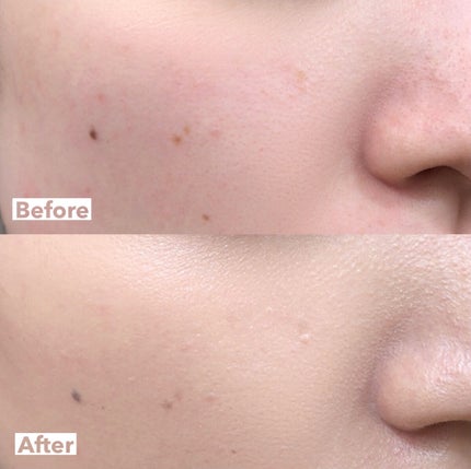 フェイス ブラー フィニッシング パウダー/Dear.A/ルースパウダーを使ったクチコミ(6枚目)