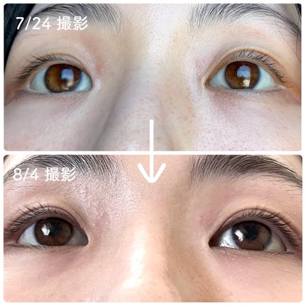 リアルミービオテノールラッシュアップアンプル/ベリサム/まつげ美容液を使ったクチコミ(4枚目)