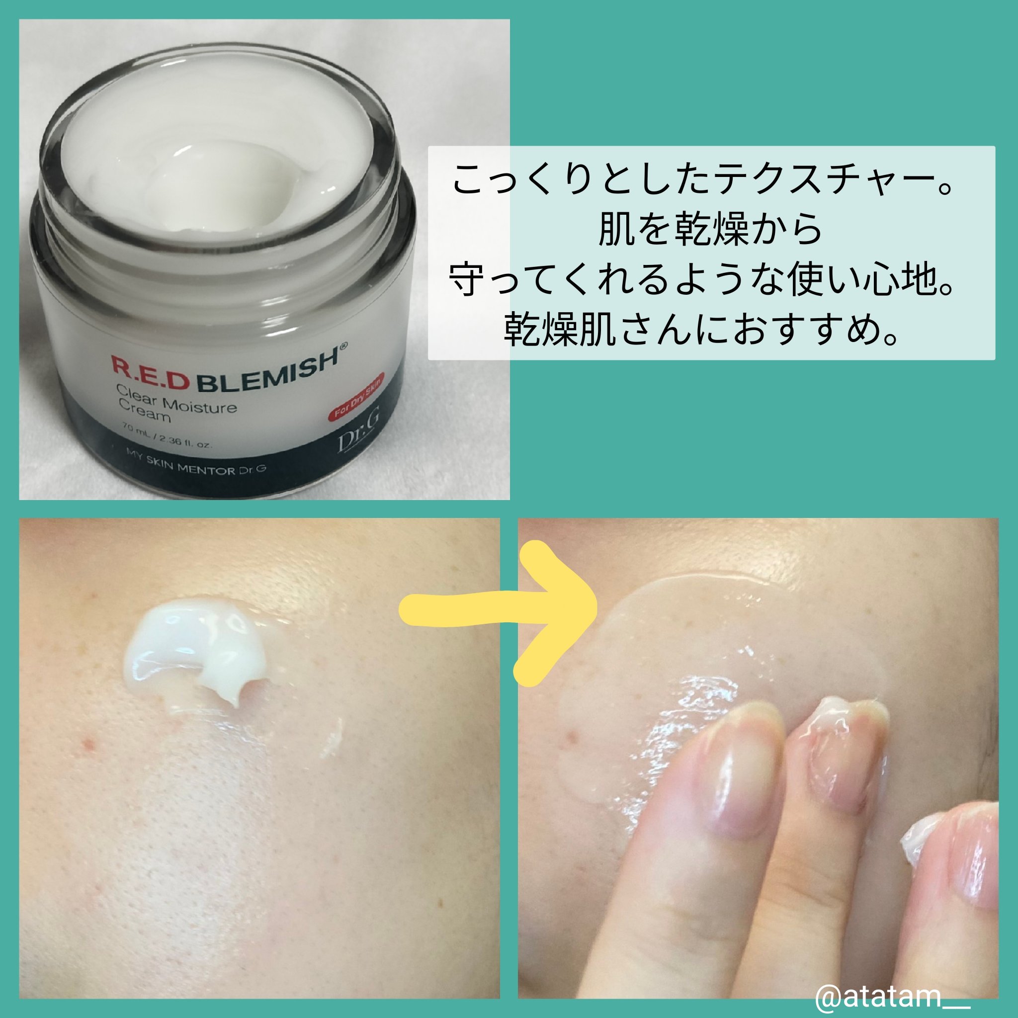 レッドブレミッシュ クリアスージングクリーム/Dr.G/フェイスクリームを使ったクチコミ（2枚目）