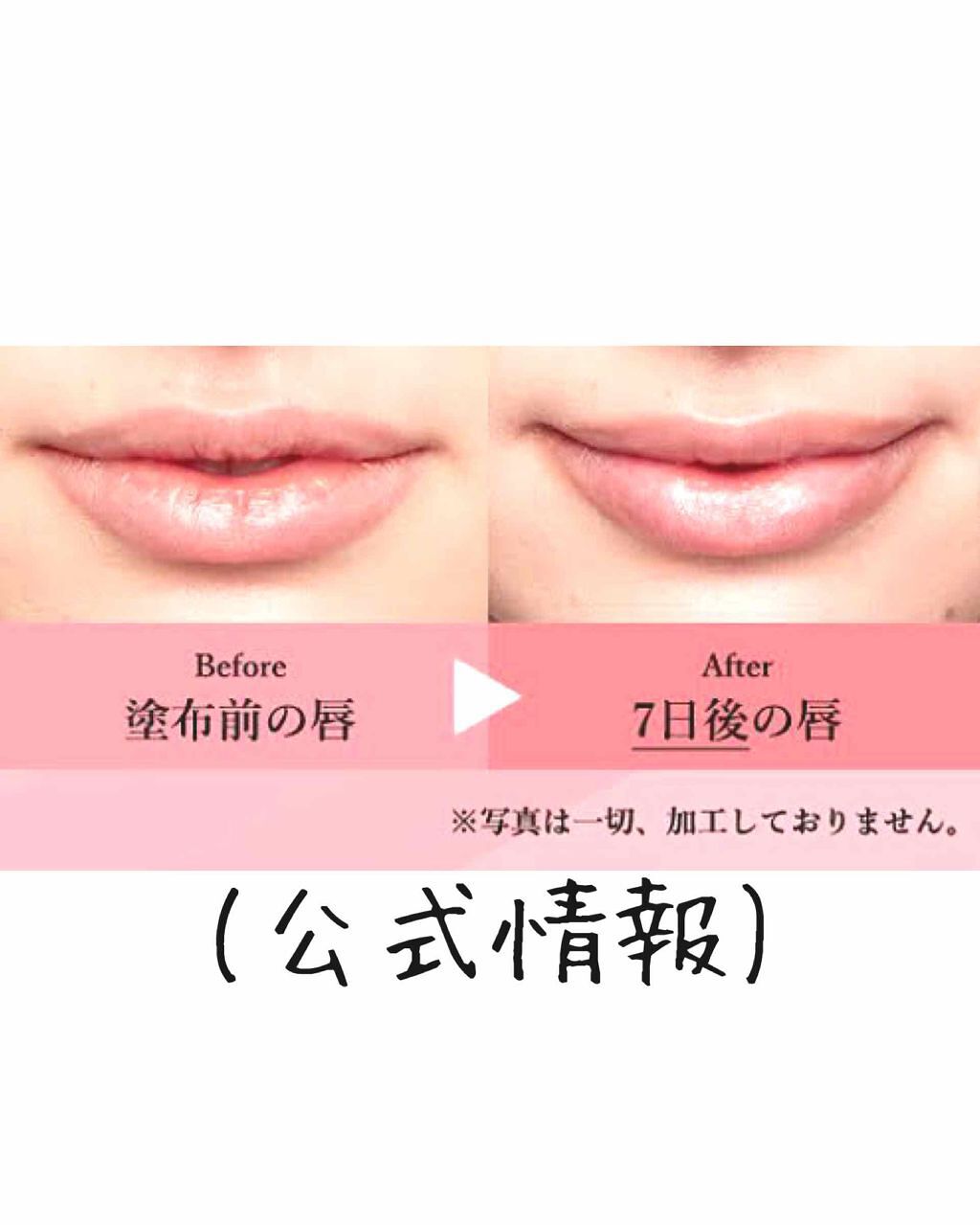 38°C / 99°F リップトリートメント (リップ美容液)/UZU BY FLOWFUSHI/リップケアを使ったクチコミ（3枚目）