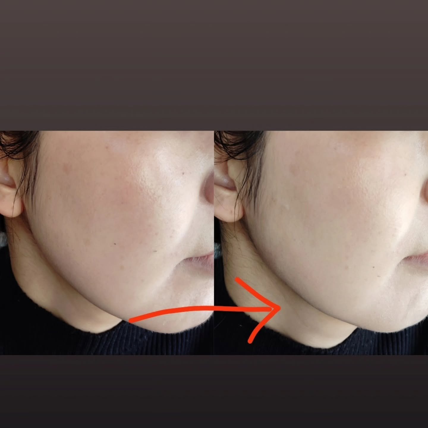 ハートリーフシーンカバークッション/23years old/クッションファンデーションを使ったクチコミ（2枚目）