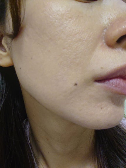 薬用パウダー化粧水/メンソレータム アクネス/化粧水を使ったクチコミ(4枚目)