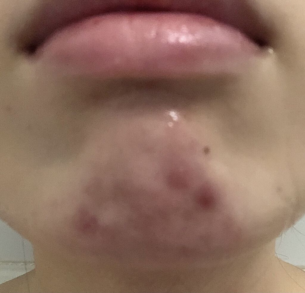 シカフルアンプル/beplain/美容液を使ったクチコミ（2枚目）