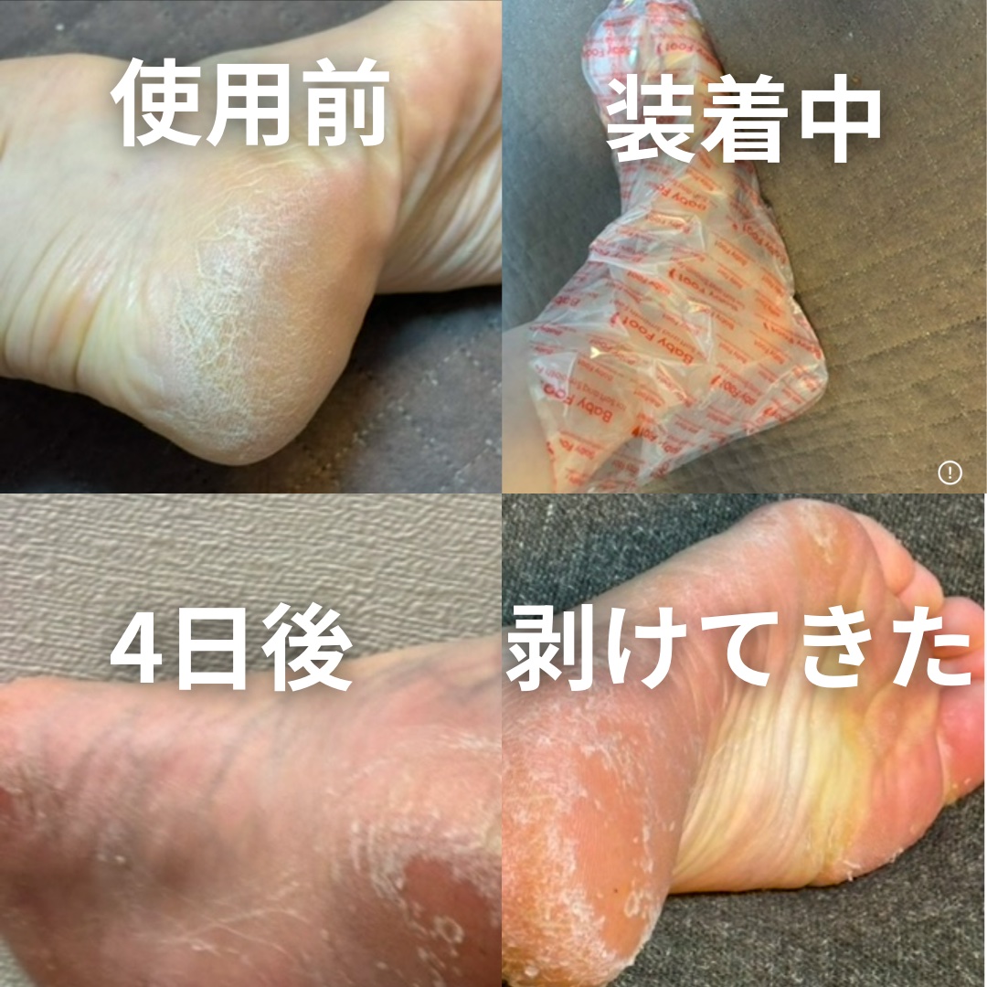 イージーパックDP60分タイプ 60分タイプ Sサイズ/ベビーフット/レッグ・フットケアを使ったクチコミ（2枚目）