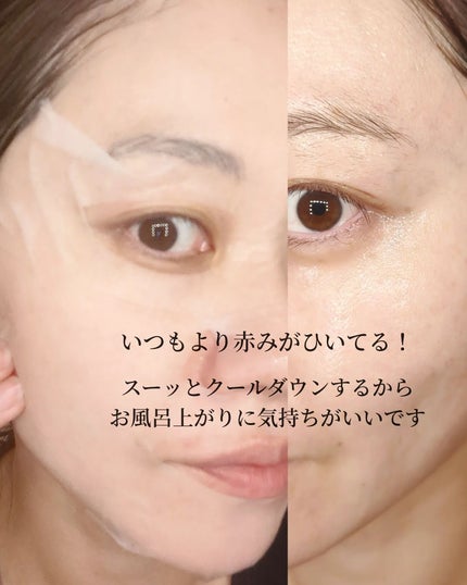 レッドブレミッシュ クールスージングマスク/Dr.G/シートマスク・パックを使ったクチコミ(4枚目)