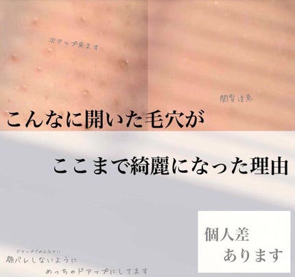 ハトムギ化粧水(ナチュリエ スキンコンディショナー R )/ナチュリエ/化粧水を使ったクチコミ(1枚目)