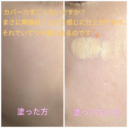 極潤 パーフェクトゲル/肌ラボ/オールインワン化粧品を使ったクチコミ(5枚目)