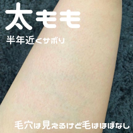 光美容器KE-NON(ケノン)/エムテック/家庭用脱毛器を使ったクチコミ(4枚目)