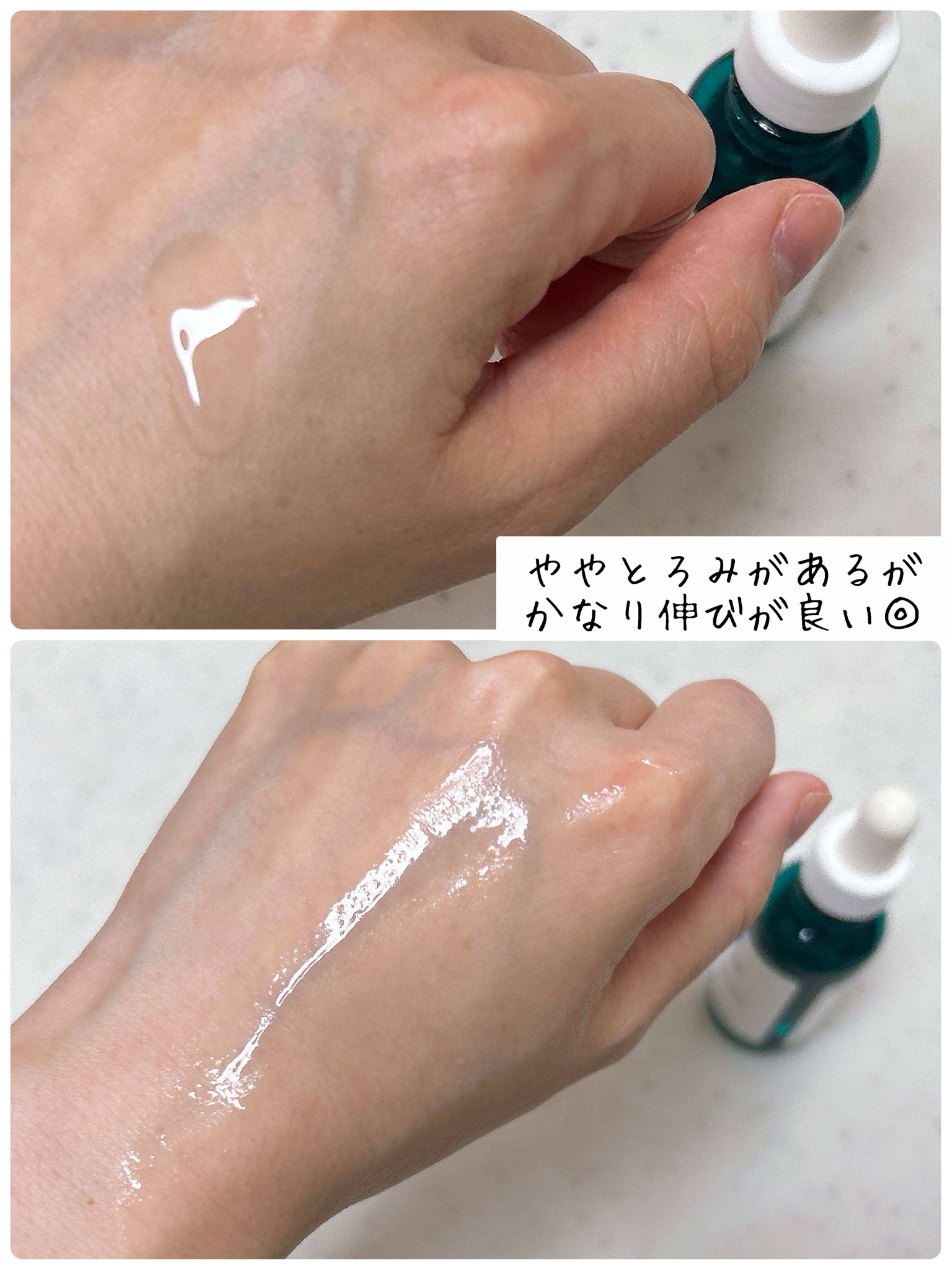 エファクラ ピールケア セラム/ラ ロッシュ ポゼ/美容液を使ったクチコミ（2枚目）