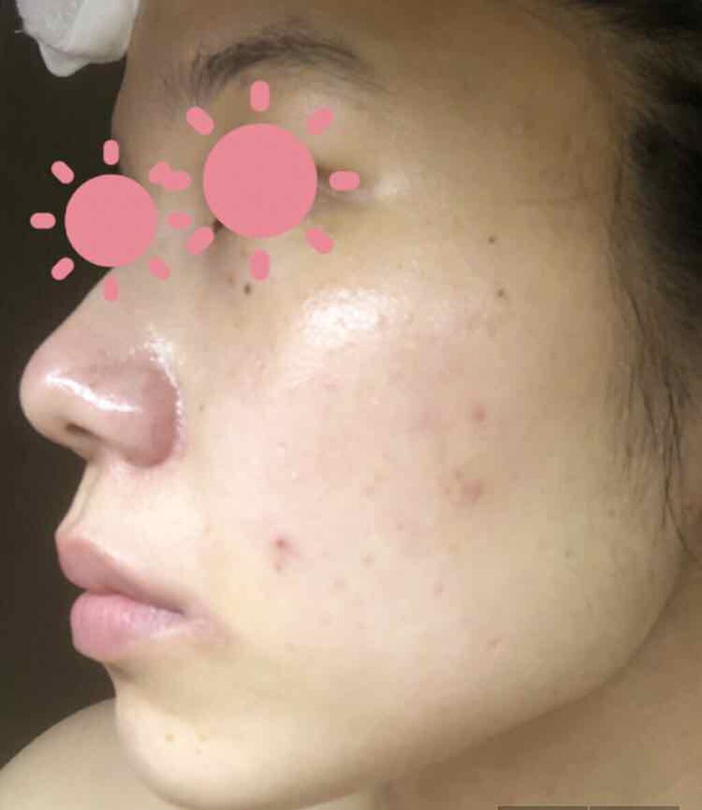 オバジC10セラム/オバジ/美容液を使ったクチコミ(4枚目)