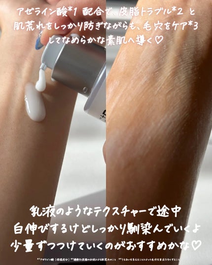 アゼペア 美容液/ネイチャーリパブリック/美容液を使ったクチコミ(4枚目)