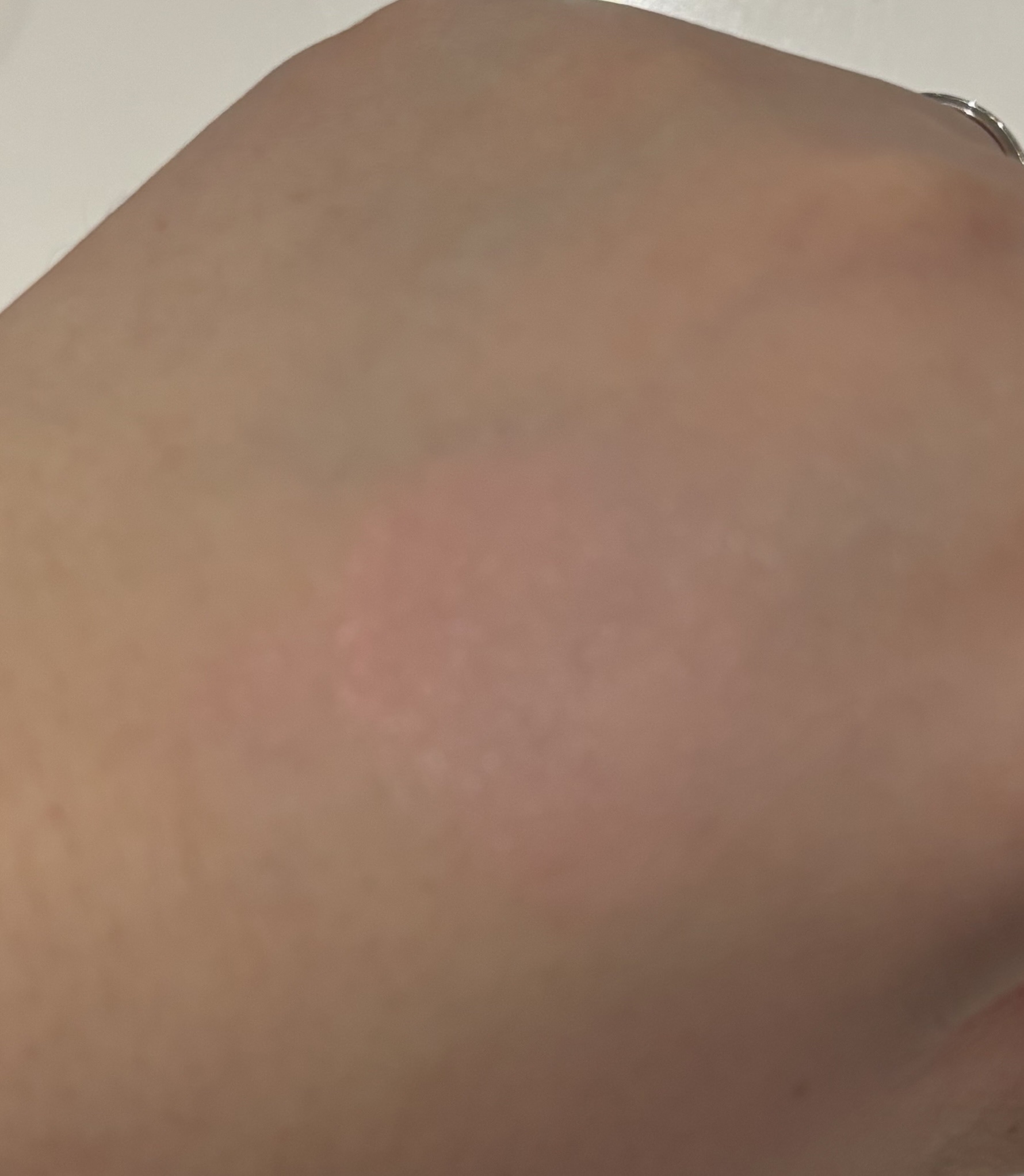 ハイドロデュイティント/Dear.A/リップティントを使ったクチコミ（2枚目）