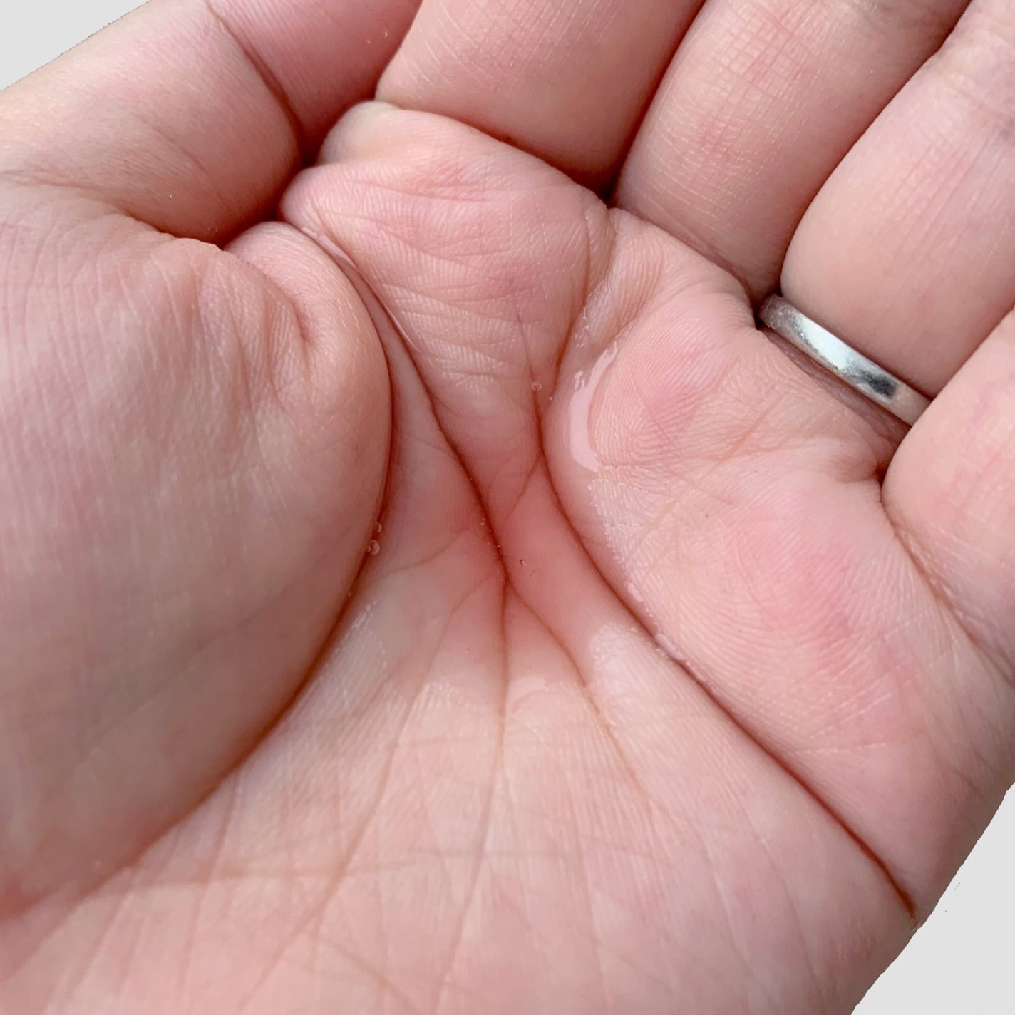 アンチリンクルファーストエッセンスオリジン/MIGUHARA/化粧水を使ったクチコミ(5枚目)